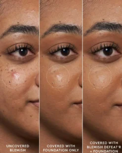 Blemish Defeat'r BHA Spot-Targeting Gel