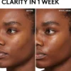 Cherry Dub BHA Toner with Salicylic Acid + Aloe Juice