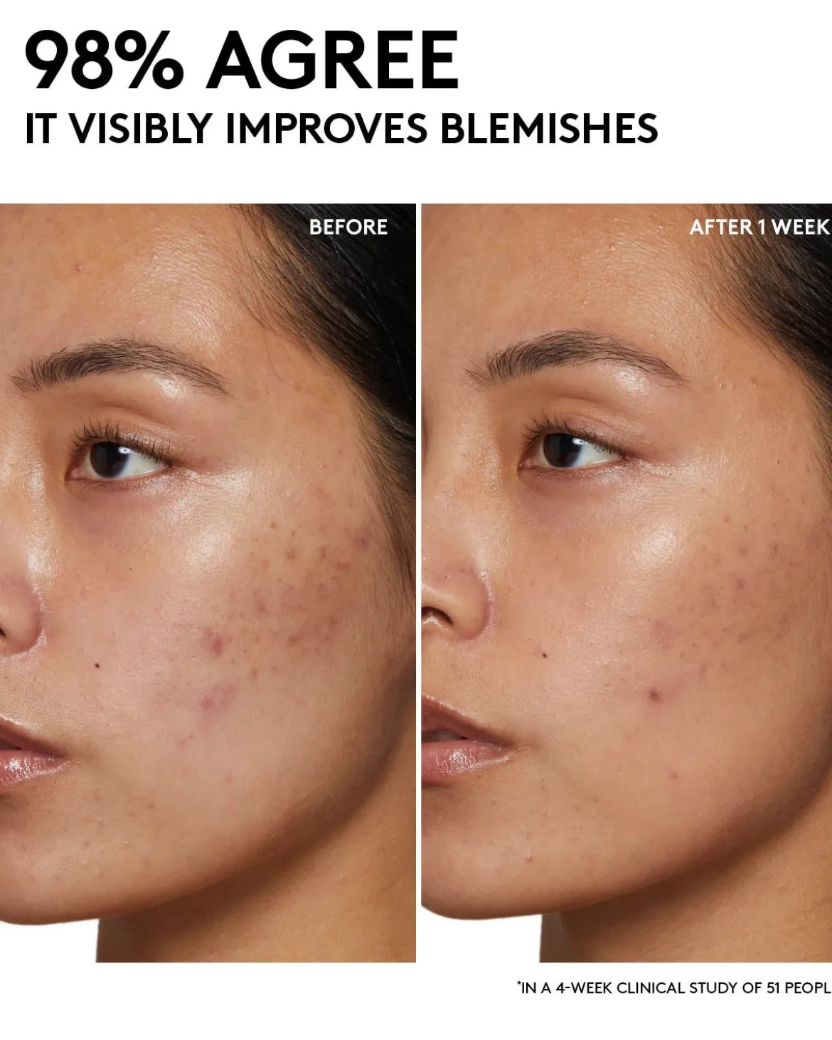 Cherry Dub Pore Purify'r Gel Cleanser with Niacinamide + Aloe Juice