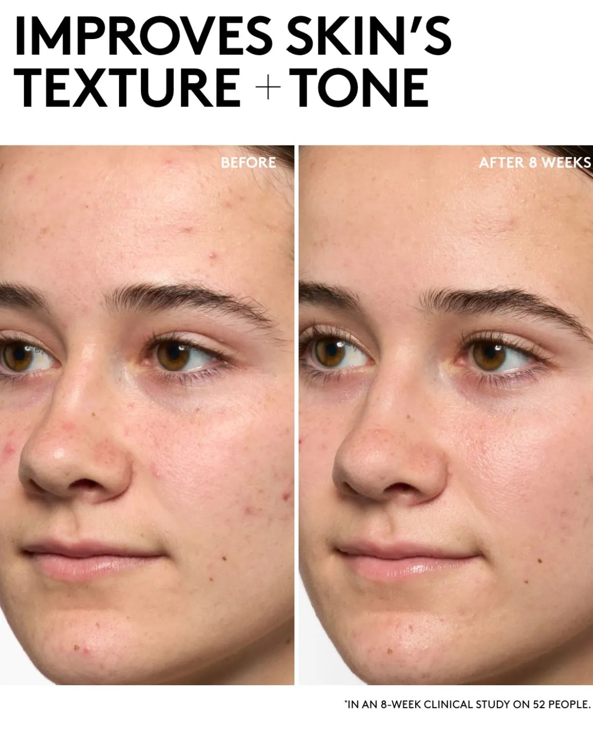 Hydra Vizor Invisible Moisturizer Broad Spectrum SPF 30 Sunscreen with Niacinamide + Kalahari Melon